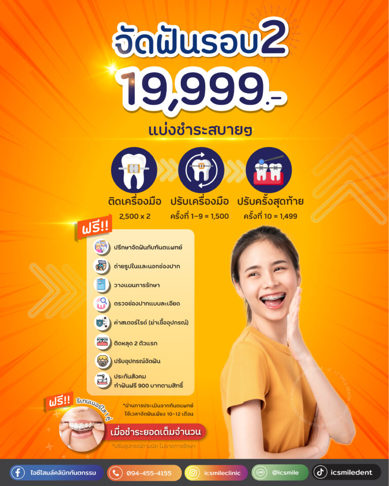 จัดฟันรอบ2 ราคาเดียว