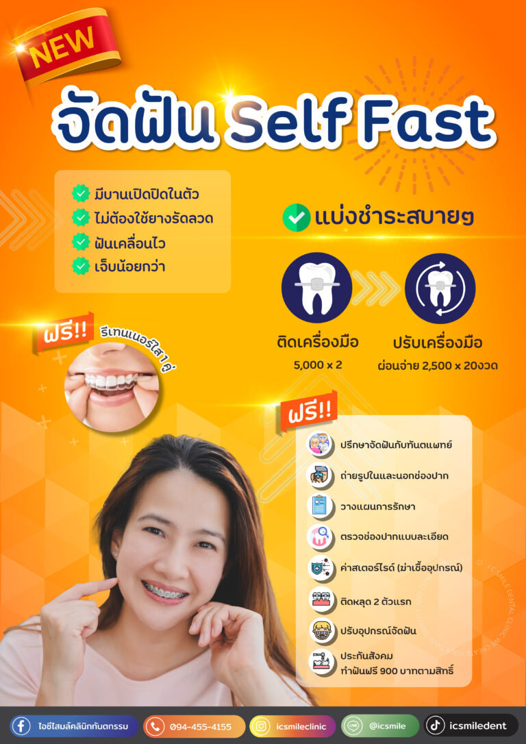 จัดฟันSelf-Fast