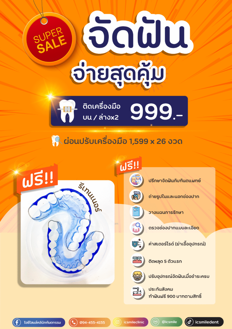 จัดฟัน