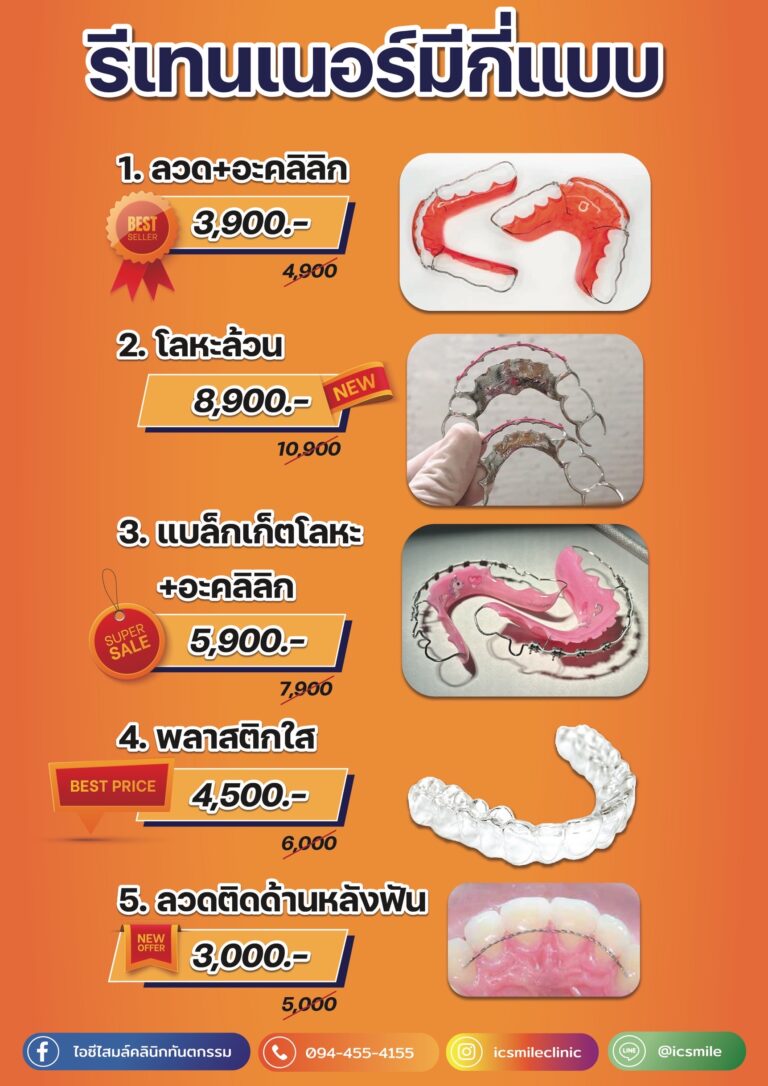 รีเทนเนอร์